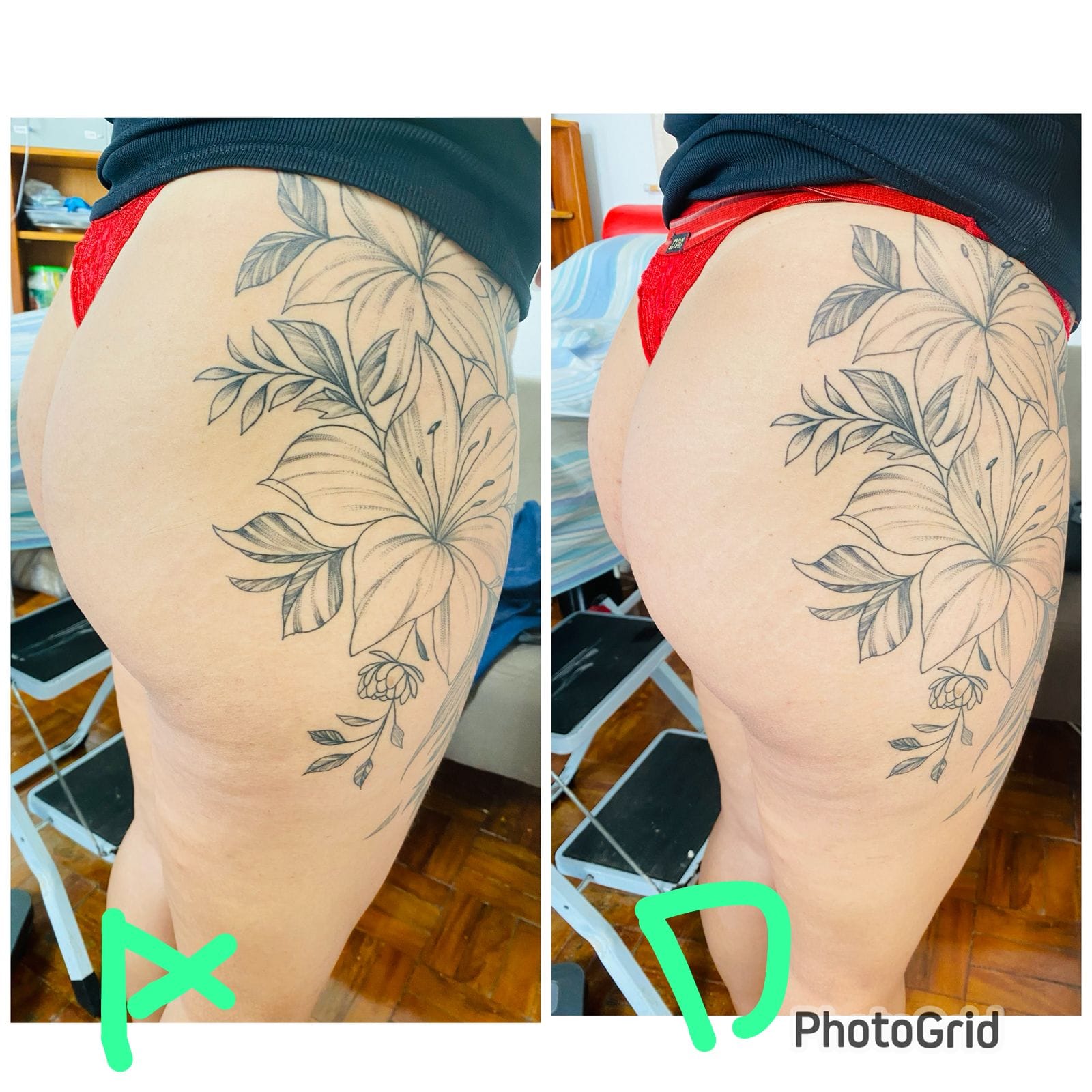 Antes e depois: cuidado com a pele
