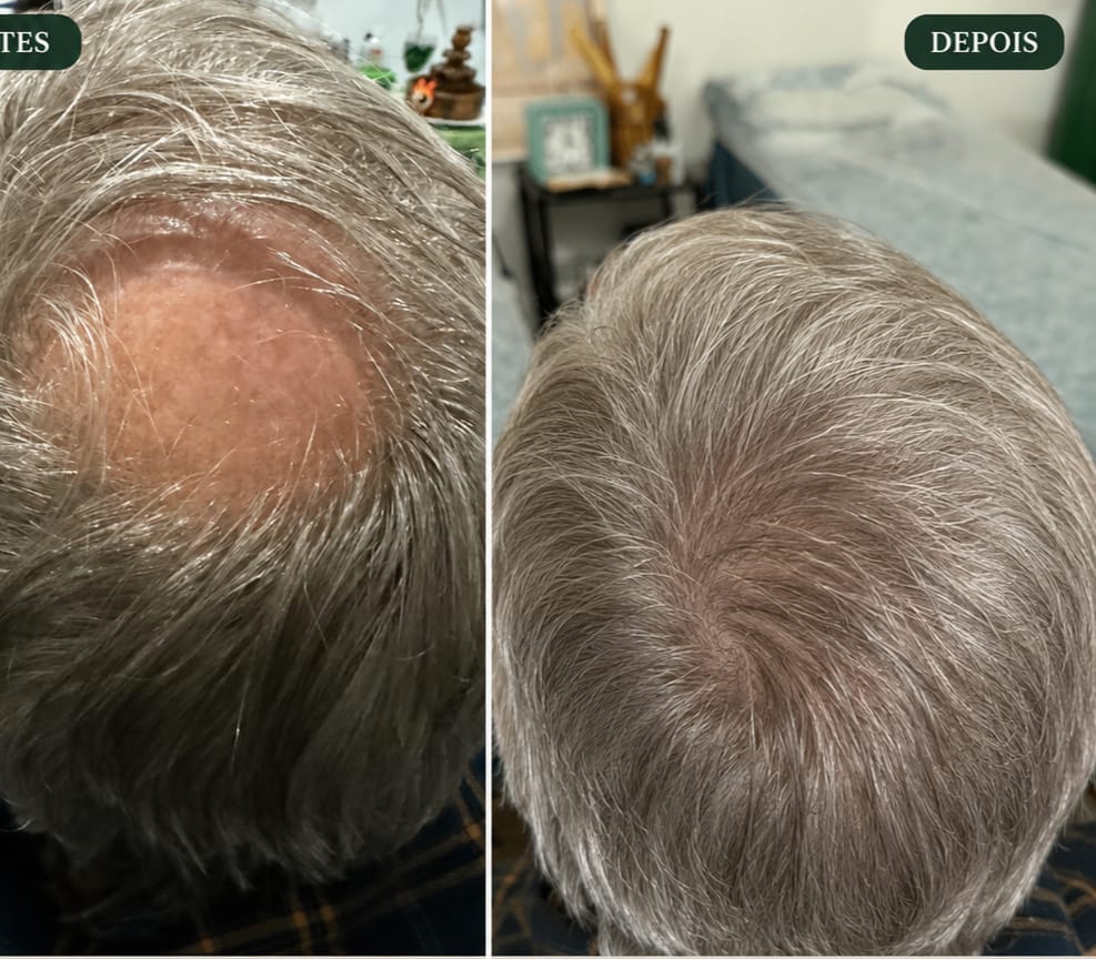 Antes e depois: fortalecimento capilar